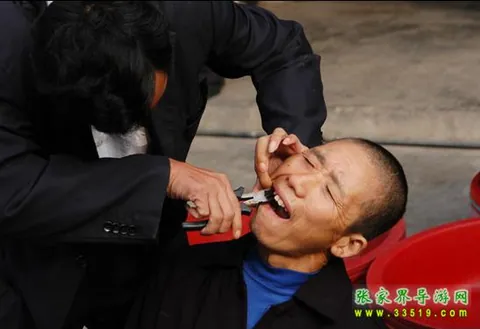 Traditional Tujia Tooth Extraction